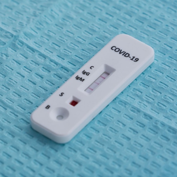 On-Site Covid-19 ANTIBODY Test (Home or Office,  15-Minute Results)